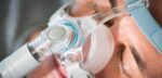 Close-up of a person wearing a CPAP mask over their nose for breathing support during sleep.