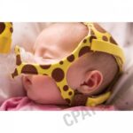 Sleeping baby wearing a yellow and brown giraffe-patterned CPAP mask with nasal prongs.