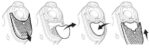 A diagram illustrating the various stages of ResMed AirMini Travel CPAP Mask Filters (4 Pack) mouth.