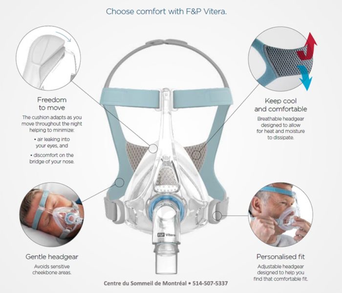 A diagram showing the features of a Fisher & Paykel Vitera Full Face CPAP Mask used for CPAP.