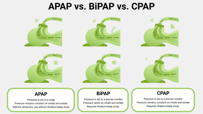 PAP Therapies Compared: AP vs BP vs CP.