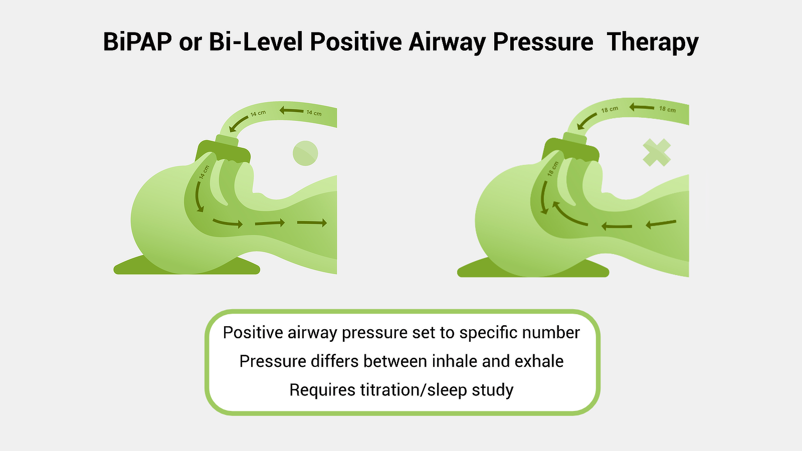 Bi Level Positive Airway Pressure Therapy Diagram 