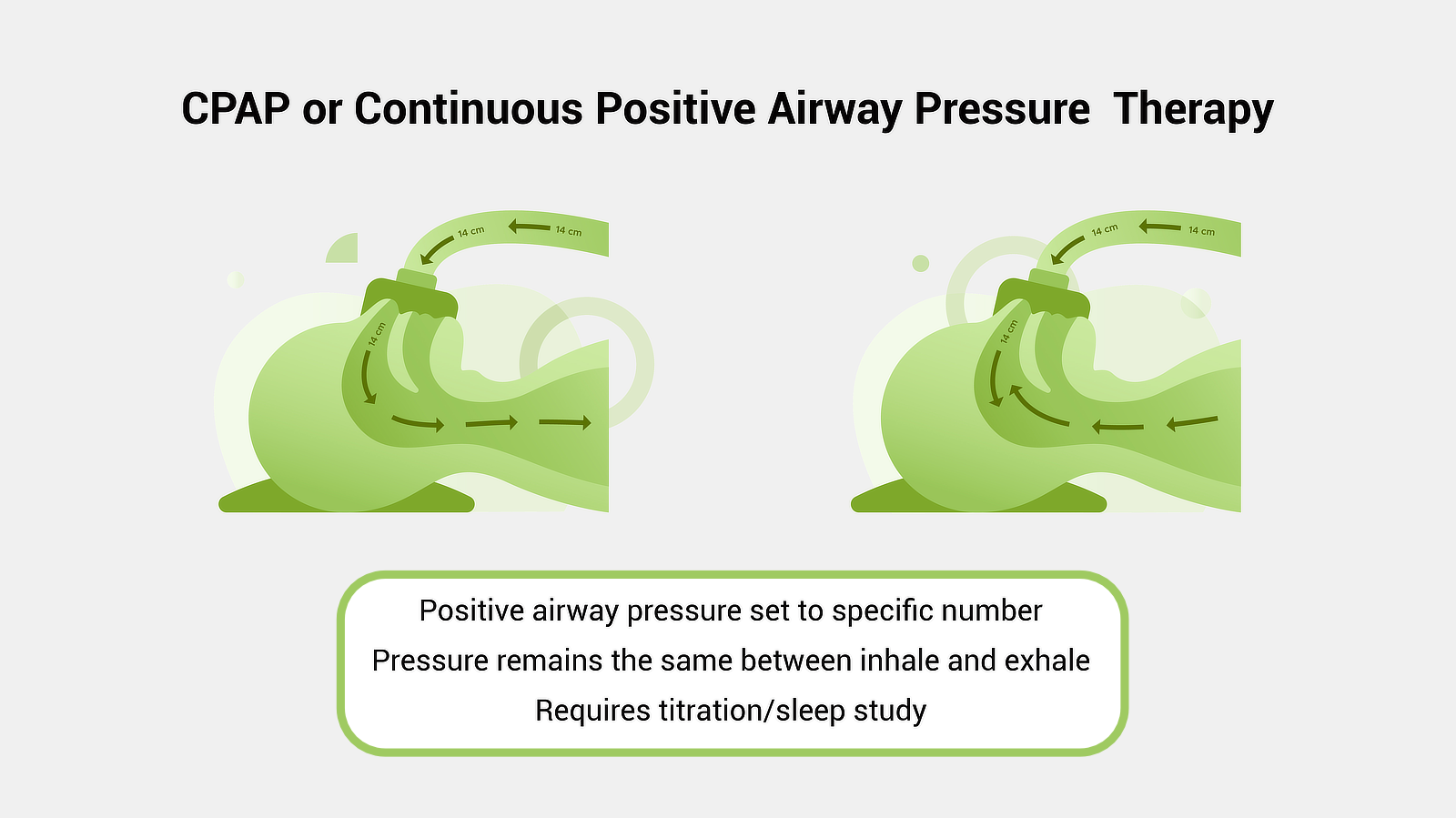 Pap Therapies Compared Apap Vs Bipap Vs Cpap Cpapsupply Ca