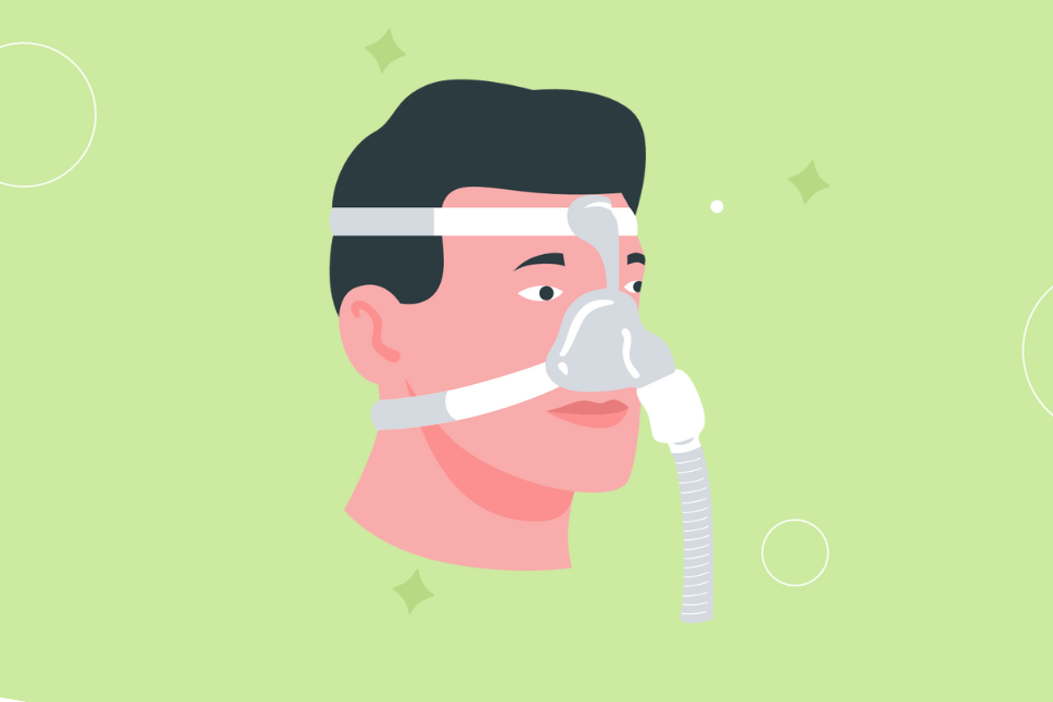 An illustration of a man wearing a nasal CPAP mask.