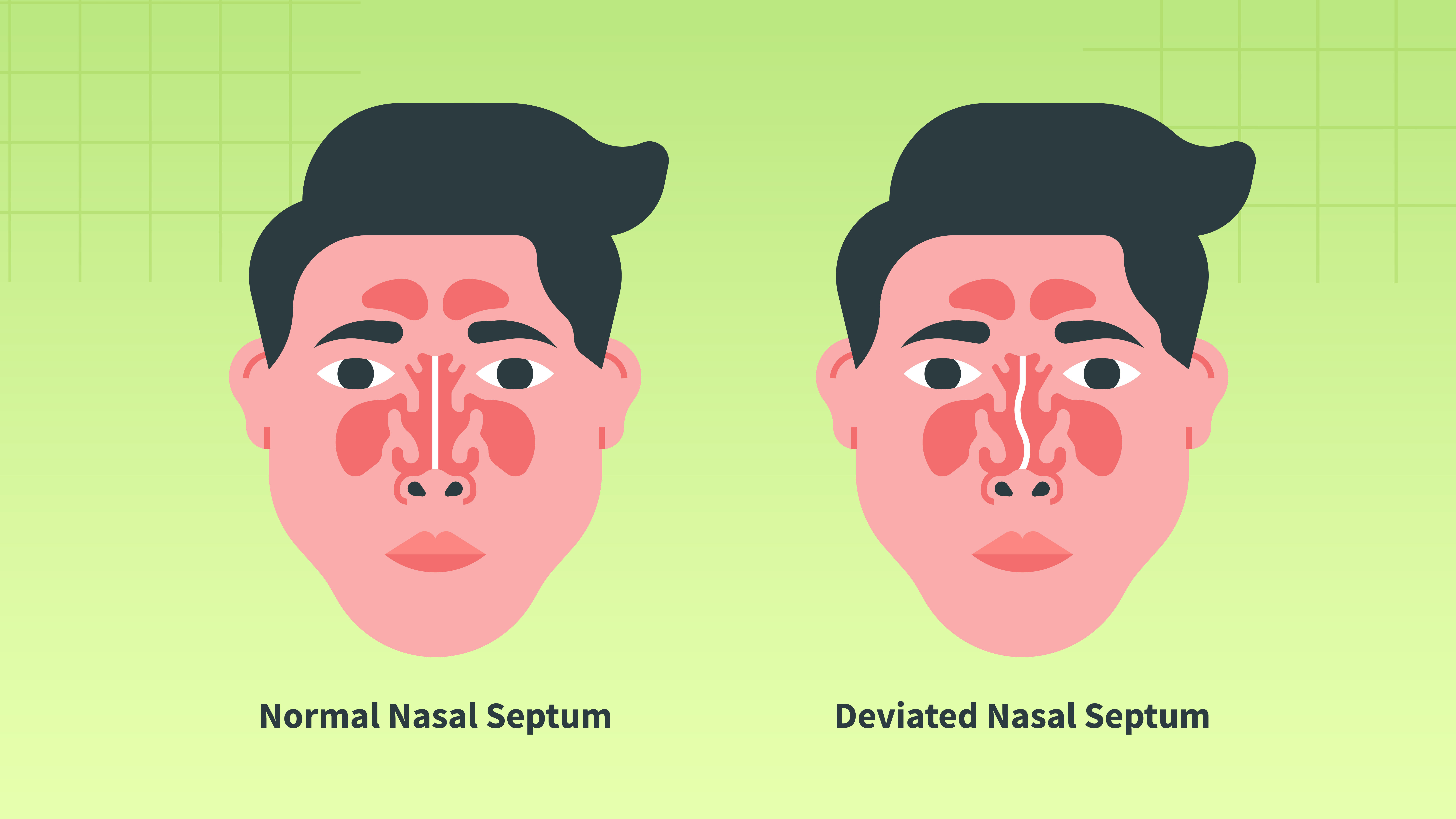 The Nose Knows: A Simple Guide to Self-Testing for Deviated Septum through the man's nose and the woman's nose.